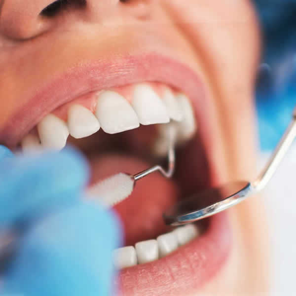 Dentistas en Bávaro, Punta Cana y La Romana - Dentists in Bavaro, Punta Cana and La Romana